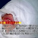 実験体モルモット患者を完全拘束マミフィケーションで犯す